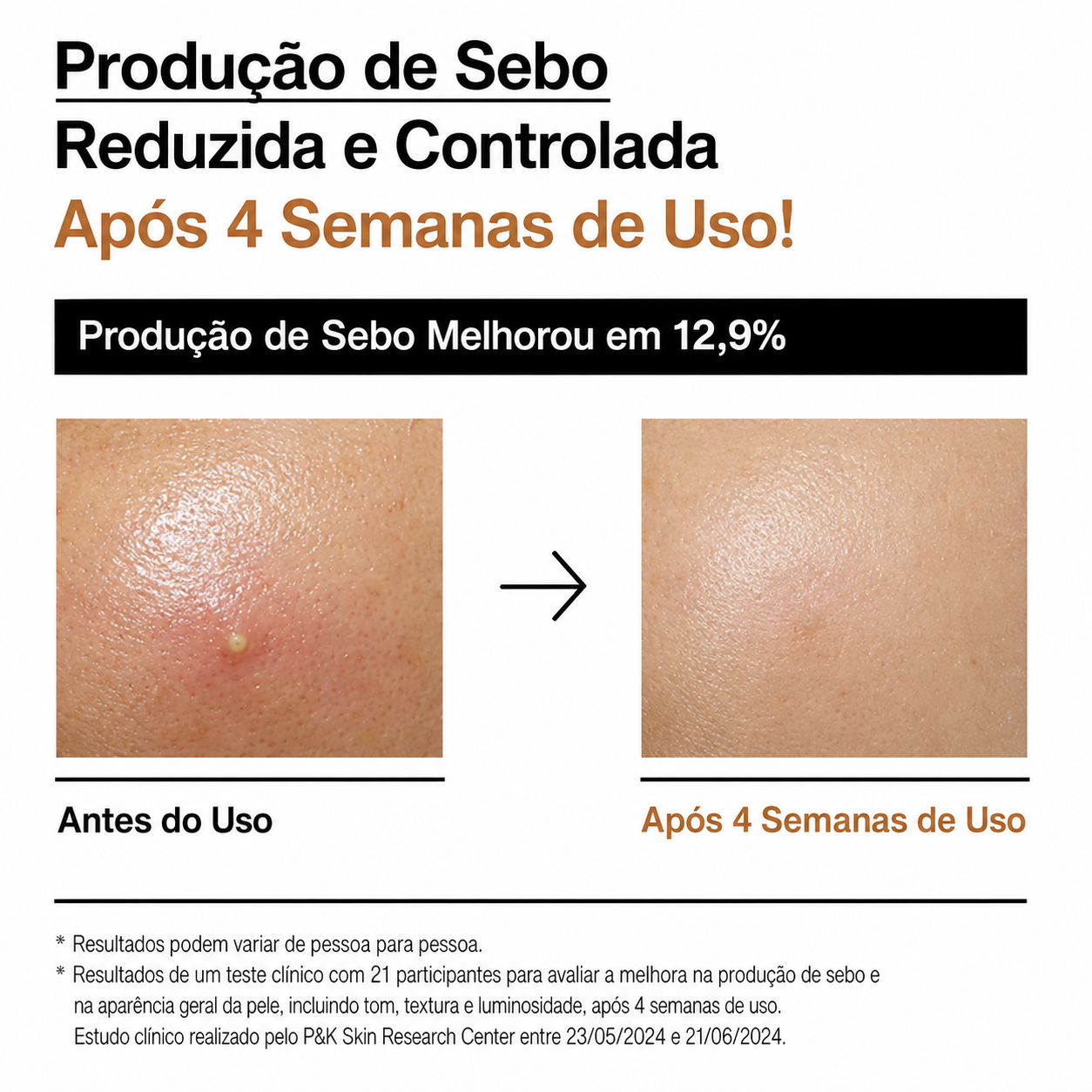 Tônico Facial Hidratante Anua Rice 70 Glow Milky Arroz