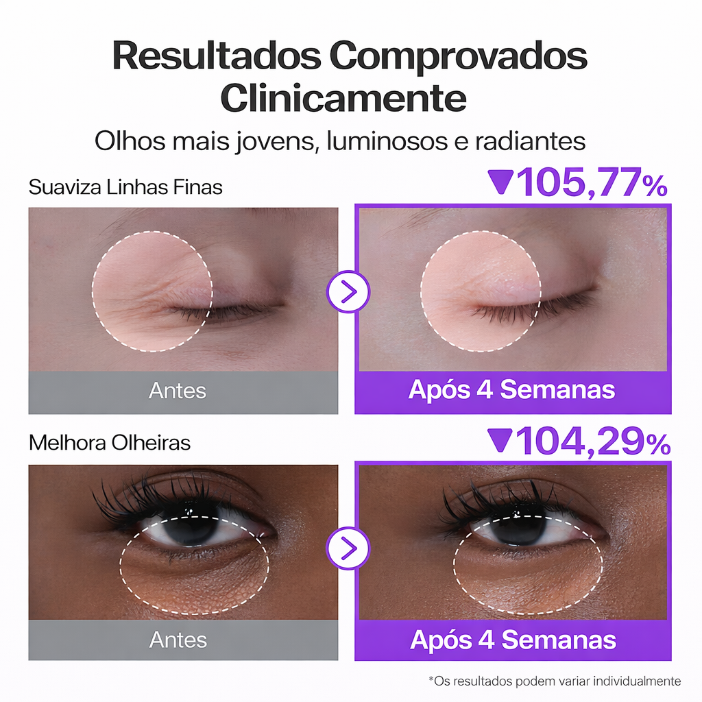 Creme Olheiras Retinol com Niacinamida 4% Numbuzin | NAD+ Peptídeos