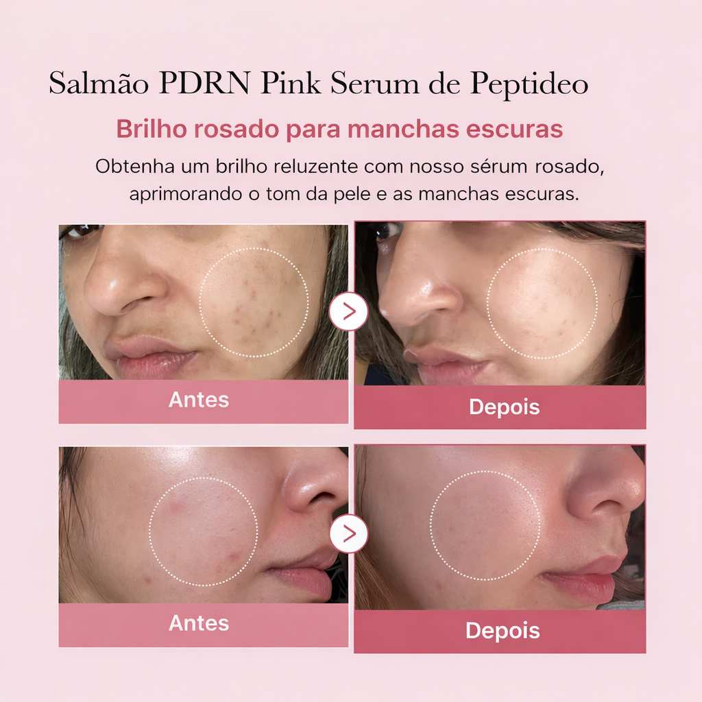Medicube Ampola Facial Rosa com PDRN de Salmão 30ml
