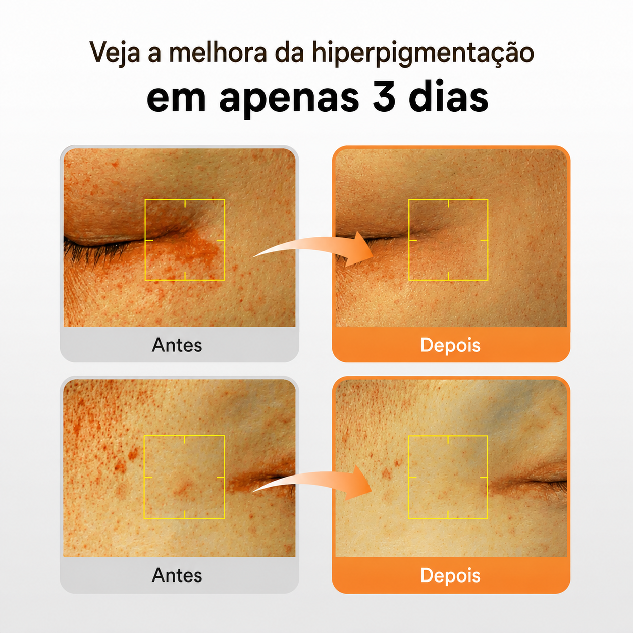 Sérum Glutationa + Vitamina C Abib | Clareador de Manchas Escuras