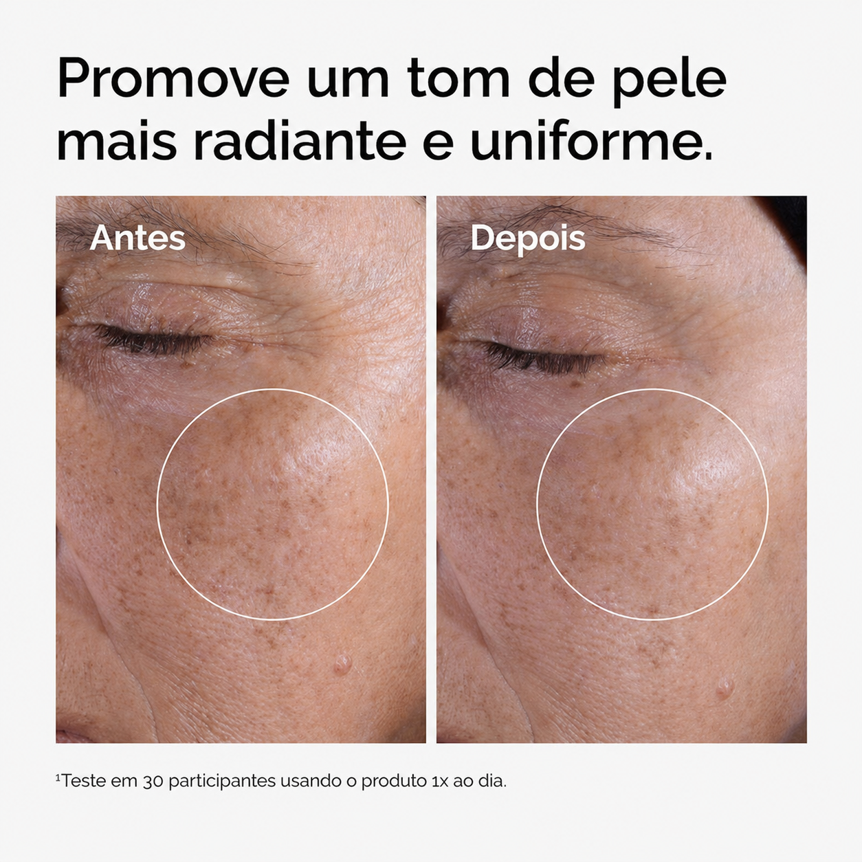 Tônico Facial Esfoliante Ácido Glicólico 7% The Ordinary | Poros e Textura