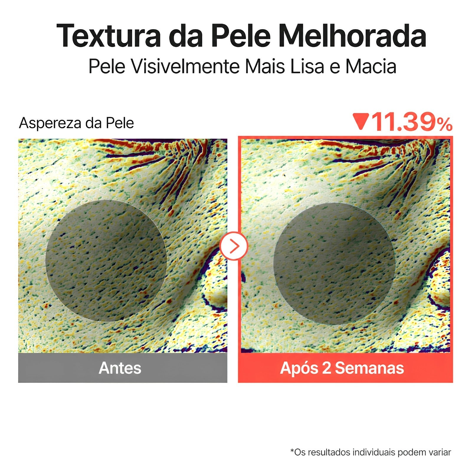 Sérum Niacinamida Numbuzin No.3 Poros e Textura