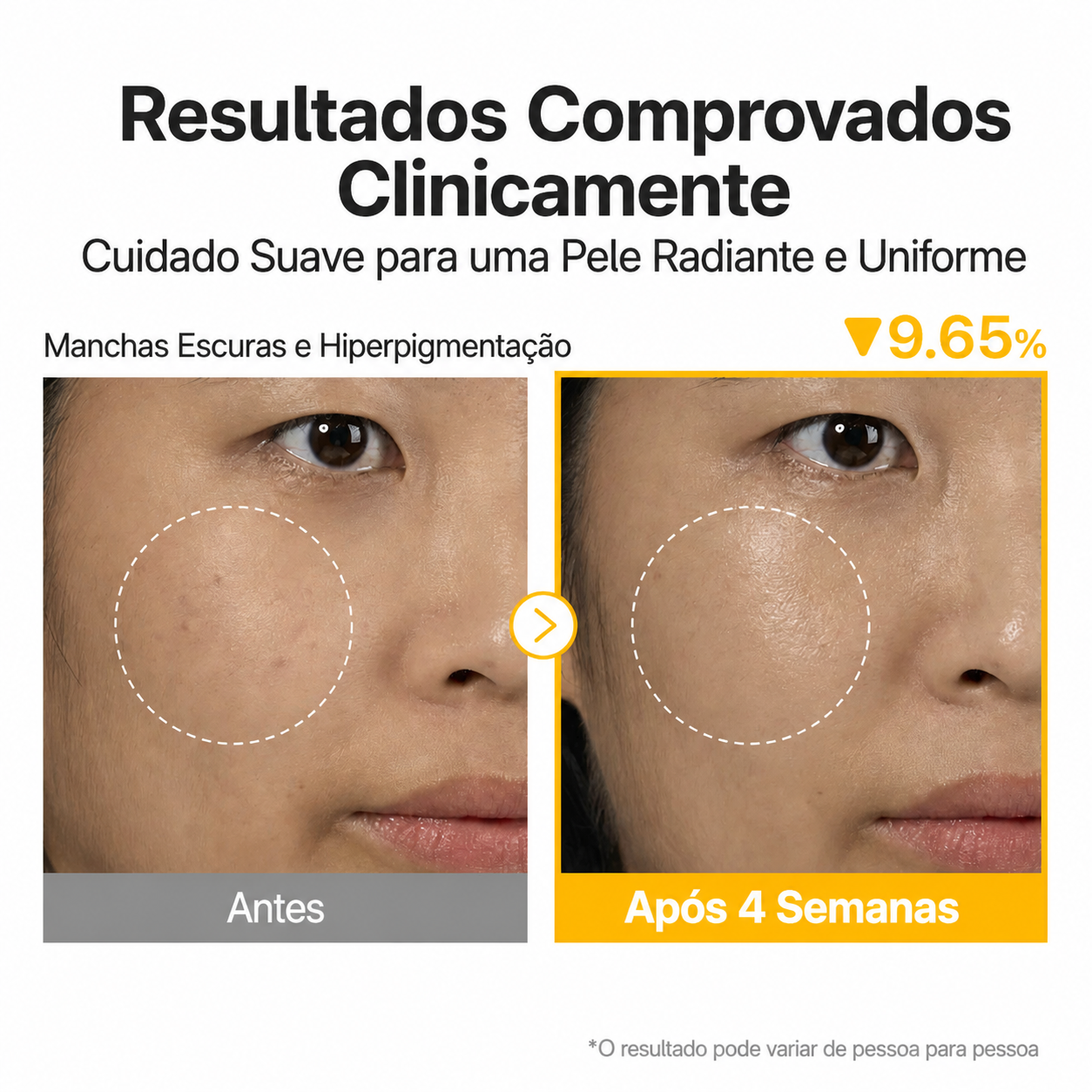 Sérum Vitamina C Numbuzin No.5 com Ácido Tranexâmico + Niancinamida