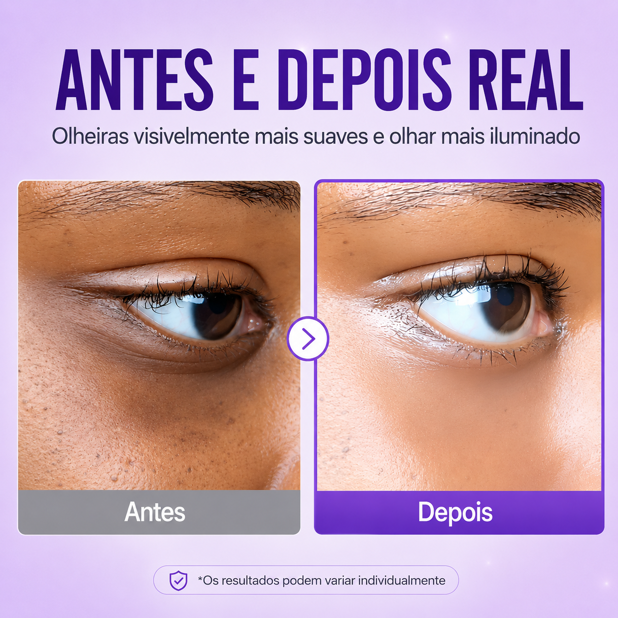 Creme Para Olheiras com Retinol e Niacinamida 4% Numbuzin | NAD+ Peptídeos