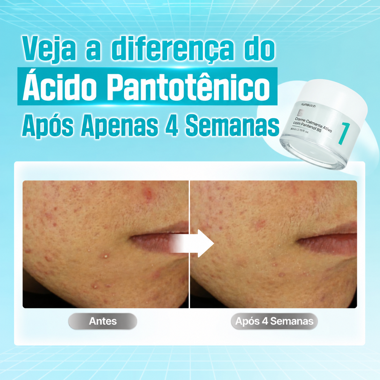 Hidratante Facial Numbuzin No.1 Ácido Pantotênico + Niacinamida 4%