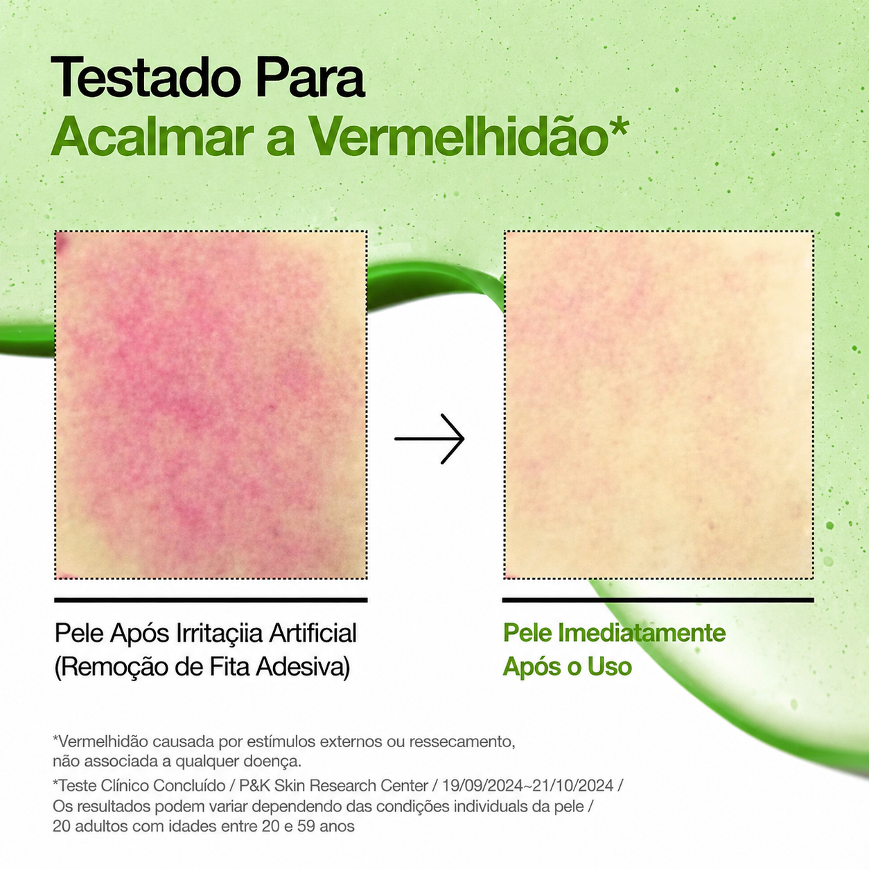Sérum Ácido Hialurônico Anua Azelaico 10 | Pele Sensivel