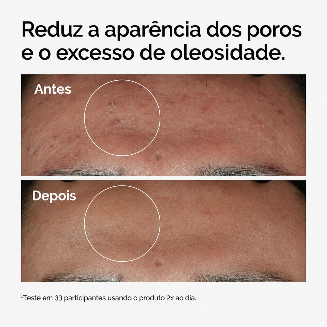 Sérum Niacinamida 10% + Zinco 1% The Ordinary | Poros e Oleosidade