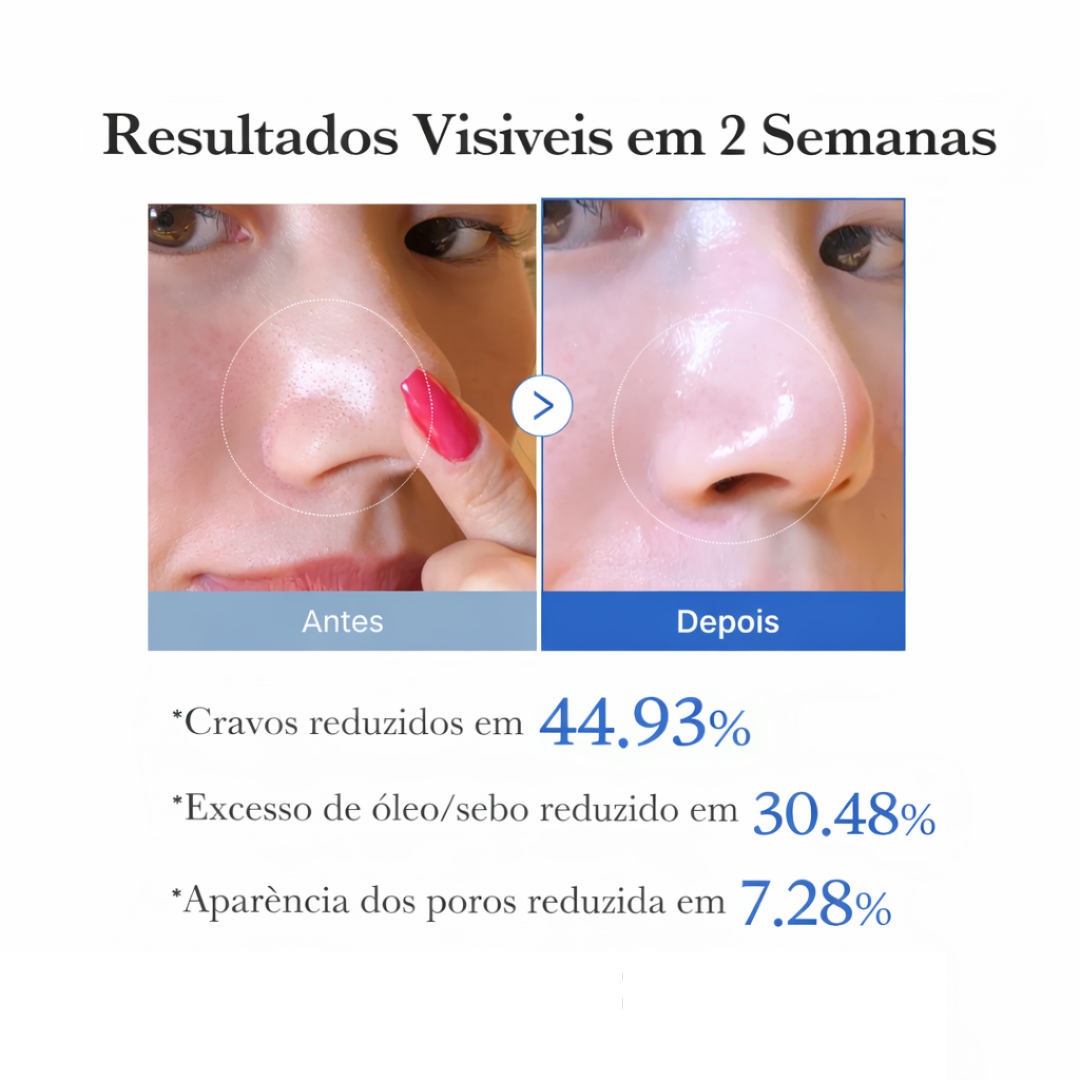 Medicube Discos para Poros Zero 2.0