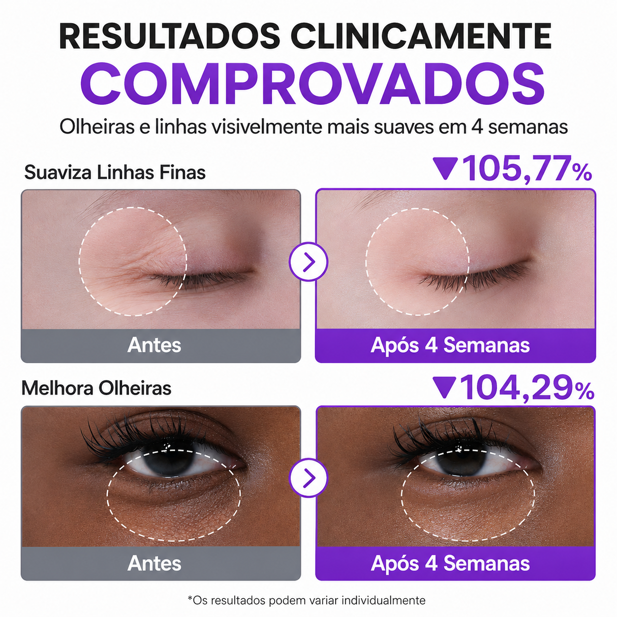 Creme Para Olheiras com Retinol e Niacinamida 4% Numbuzin | NAD+ Peptídeos
